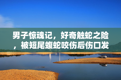 男子惊魂记，好奇触蛇之险，被短尾蝮蛇咬伤后伤口发黑